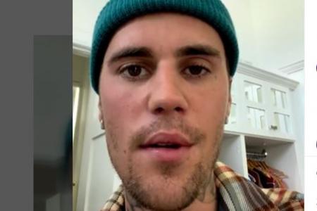 Part of Justin Bieber's face is paralysed