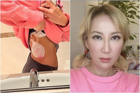 Singer Coco Lee sparks health concerns with her 42kg weight, drainage bag on her body