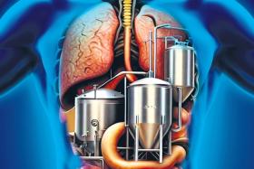 Auto-brewery syndrome is an extremely rare condition where bacteria and fungi in the gastrointestinal tract turn the carbohydrates in everyday foods into alcohol.